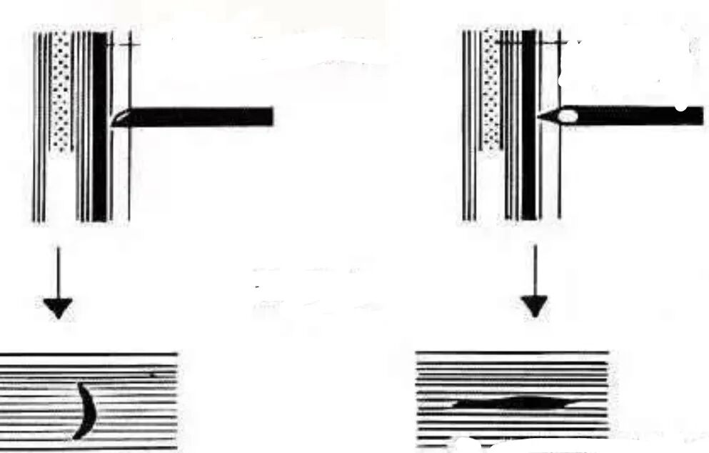 怎么知道穿刺到硬膜外硬膜外穿刺针需要略加改进_https://www.jmylbn.com_新闻资讯_第4张