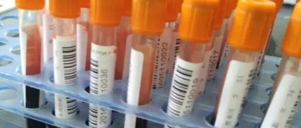 血型决定寿命？A型、B型、O型、AB型，哪种血型更容易长寿？