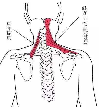 外展枕怎么使用干货 ｜ 针刀治疗要点规程定点定位_https://www.jmylbn.com_新闻资讯_第42张
