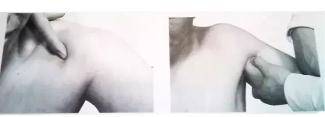 外展枕怎么使用干货 ｜ 针刀治疗要点规程定点定位_https://www.jmylbn.com_新闻资讯_第21张