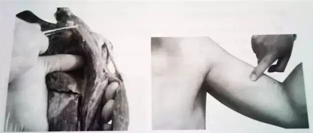 外展枕怎么使用干货 ｜ 针刀治疗要点规程定点定位_https://www.jmylbn.com_新闻资讯_第22张