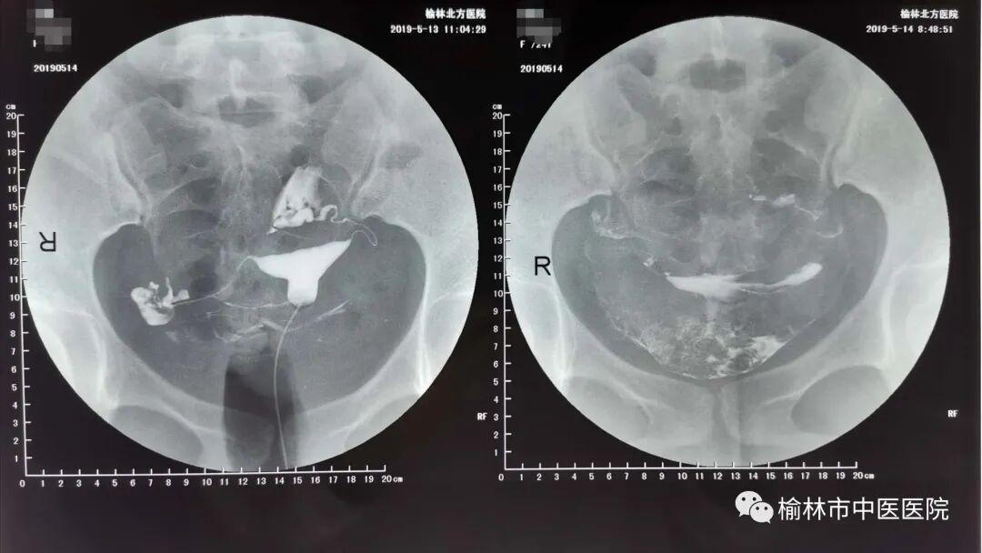 妇科离子导入治疗什么打造专业妇科，关爱女性健康——榆林市中医医院妇三科_https://www.jmylbn.com_新闻资讯_第9张
