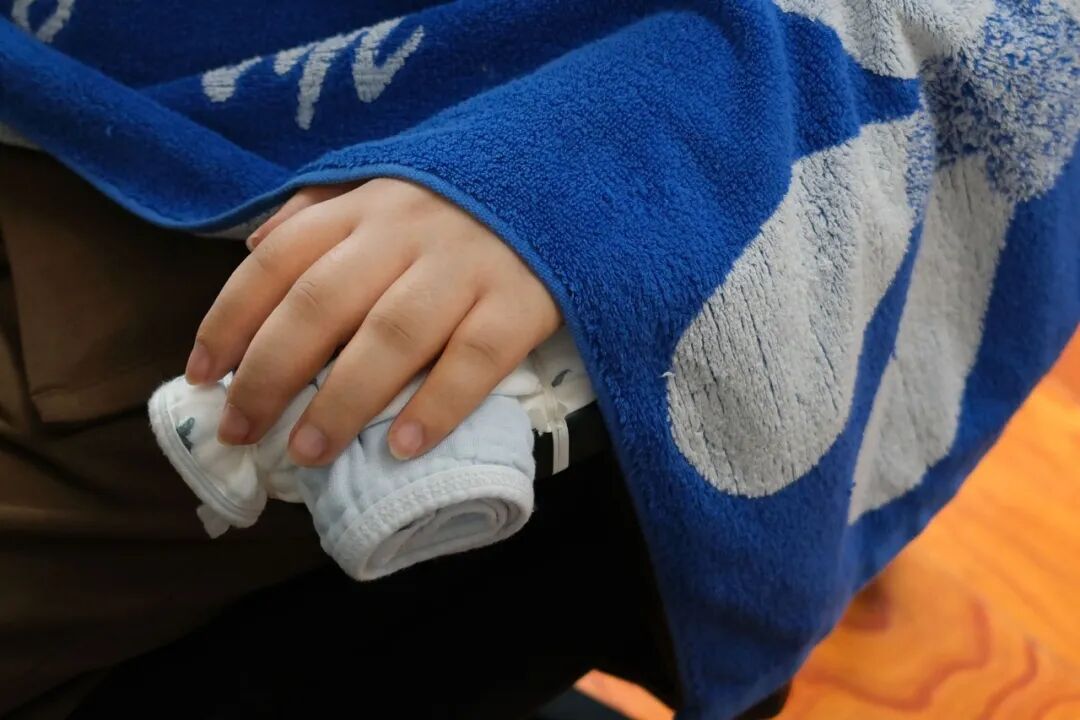 ▲蔡磊浮肿的手 图/南方人物周刊记者 梁辰