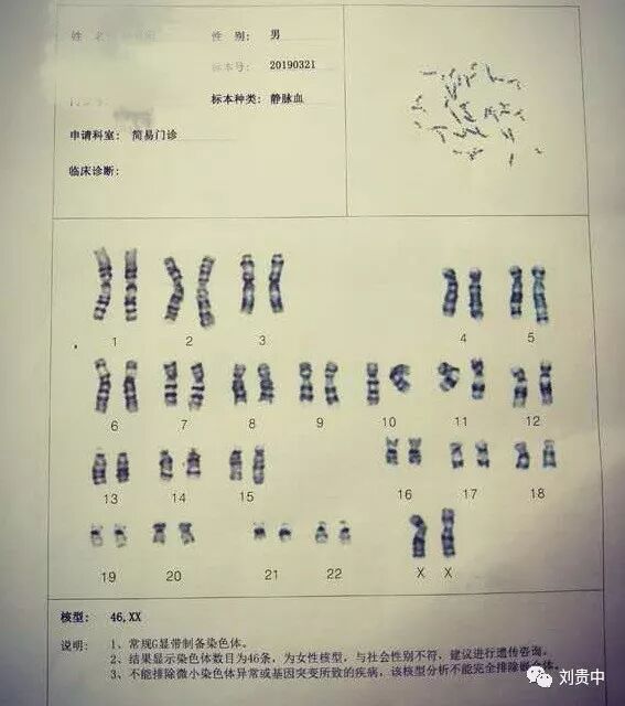 染色体核型分析及遗传学咨询之y染色体嵌合型 刘贵中 微信公众号文章阅读 Wemp