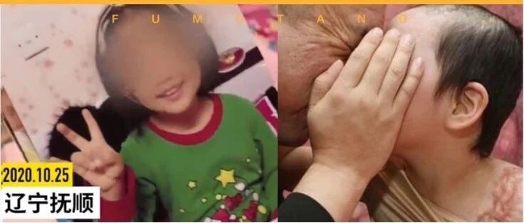 热水浇头、钳掉牙齿、掰碎胳膊……6岁女童遭亲妈及其男友残忍虐待，孩子太可怜，姥姥心疼急哭了……