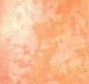 慌了！寶寶皮膚上的各種斑是疾病的徵兆？有這4種就需要注意了 親子 第6張