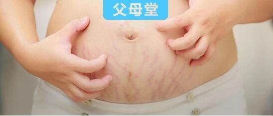 郭碧婷孕照被嘲“大妈”，高圆圆产后被吐槽像“保姆”，这几乎是女人一生中最难的2年