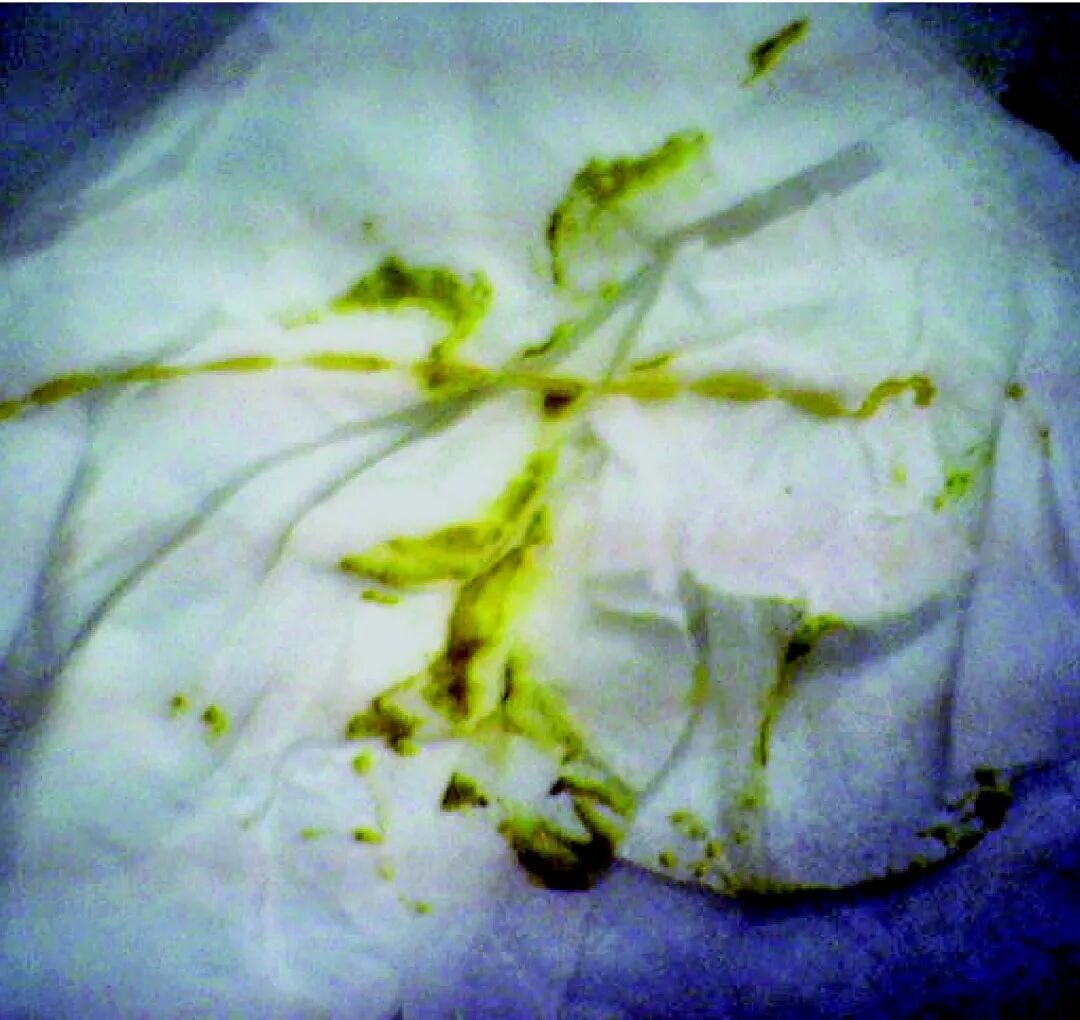 以呕吐为主的疾病类症鉴别 病症 维宠宠物导航网