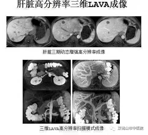 GE病人列表怎么删除【特别推荐】市中医院最新引进美国GE1.5T超导核磁共振仪、GE16排螺旋CT 服务全市广大患者_https://www.jmylbn.com_新闻资讯_第7张