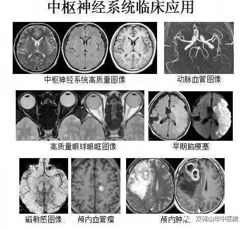 GE病人列表怎么删除【特别推荐】市中医院最新引进美国GE1.5T超导核磁共振仪、GE16排螺旋CT 服务全市广大患者_https://www.jmylbn.com_新闻资讯_第6张