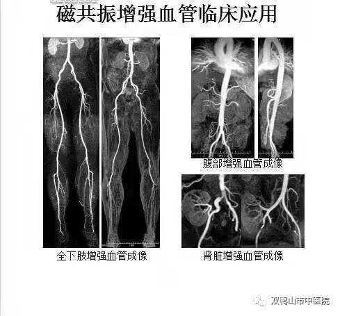 GE病人列表怎么删除【特别推荐】市中医院最新引进美国GE1.5T超导核磁共振仪、GE16排螺旋CT 服务全市广大患者_https://www.jmylbn.com_新闻资讯_第11张