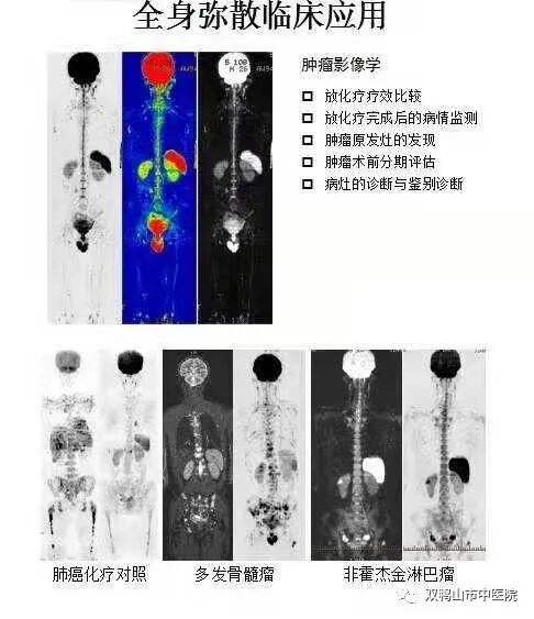 GE病人列表怎么删除【特别推荐】市中医院最新引进美国GE1.5T超导核磁共振仪、GE16排螺旋CT 服务全市广大患者_https://www.jmylbn.com_新闻资讯_第9张