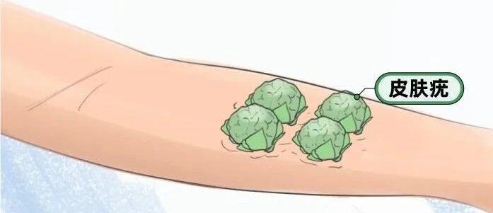 “那些爱带避孕套的女生，后来怎么样了？”