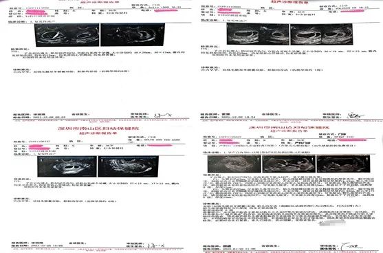 孕囊小多喝水_喝水有助于孕囊排出吗_孕囊偏小医生让多喝水