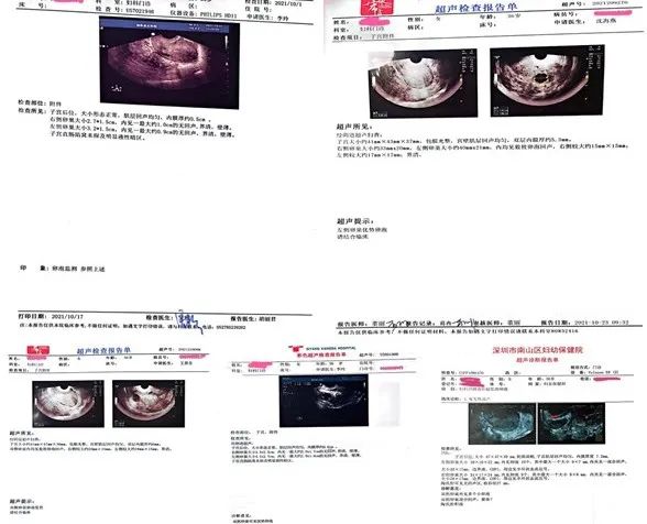 孕囊小多喝水_孕囊偏小医生让多喝水_喝水有助于孕囊排出吗