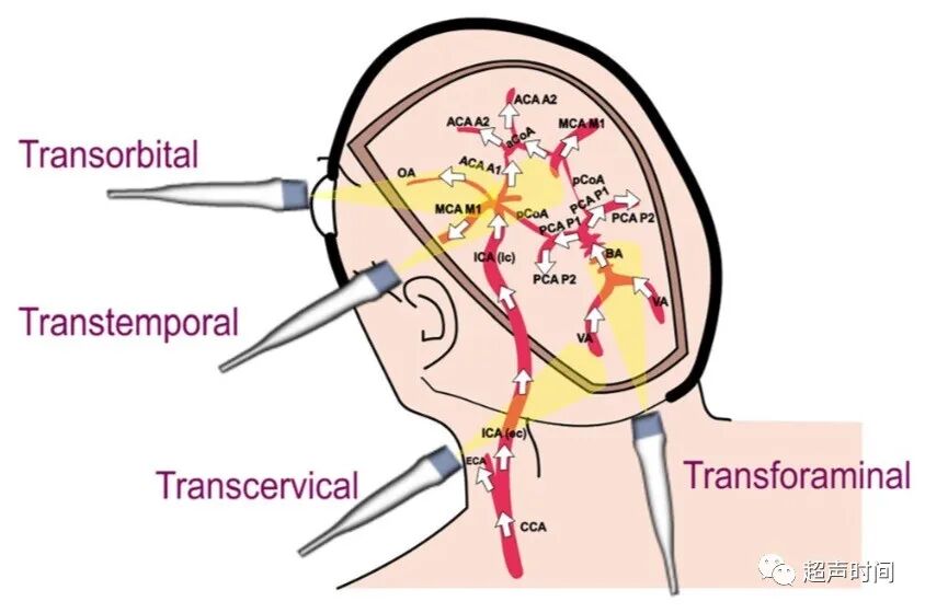 TCD怎么切换探头TCD：经颅多普勒(1-2)：基础知识、检查操作_https://www.jmylbn.com_新闻资讯_第4张