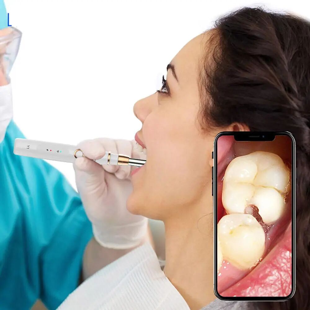 牙科骨凿怎么用「泓英口腔就诊指南」请查收！_https://www.jmylbn.com_新闻资讯_第3张