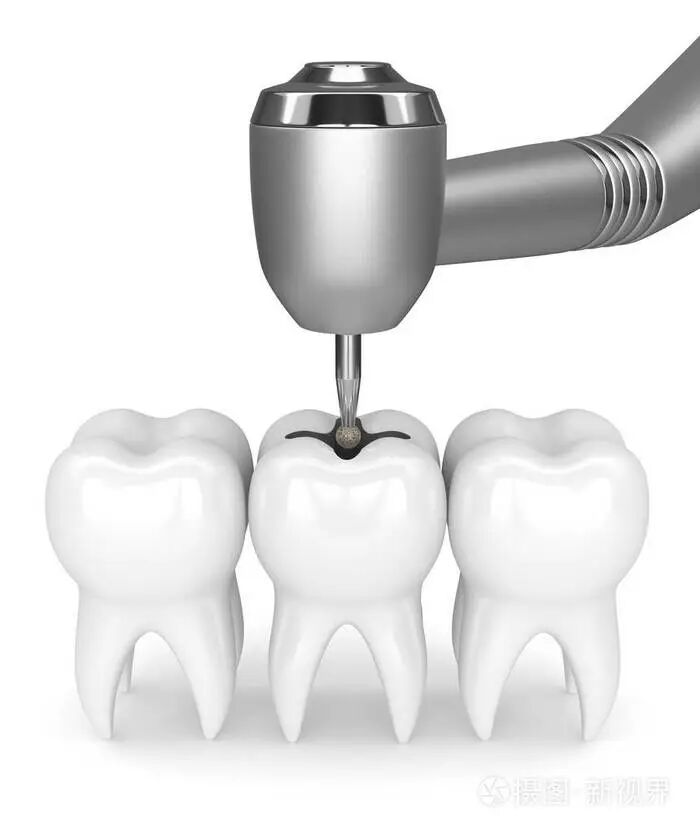 牙科骨凿怎么用「泓英口腔就诊指南」请查收！_https://www.jmylbn.com_新闻资讯_第6张