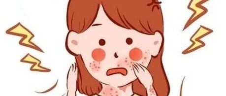 警惕不明原因反复发作的“皮疹”