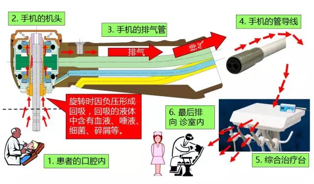 什么是牙科手机当代牙科手机的发展与中国牙科手机品牌崛起_https://www.jmylbn.com_新闻资讯_第17张