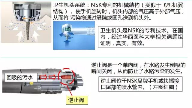 什么是牙科手机当代牙科手机的发展与中国牙科手机品牌崛起_https://www.jmylbn.com_新闻资讯_第21张