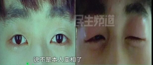 高考生住进酒店，第二天醒来照镜子崩溃了！