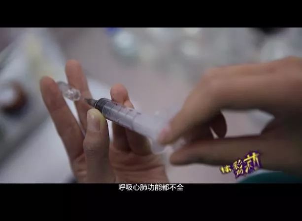 僅600克！雙胞胎男嬰早產，寶媽每天焦慮失眠... 親子 第7張