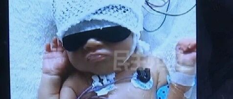 双胞胎早产儿患病，父母欲放弃治疗……你怎么看？