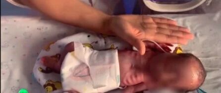 报喜！出生时790g的拇指姑娘，现在“变身”了...