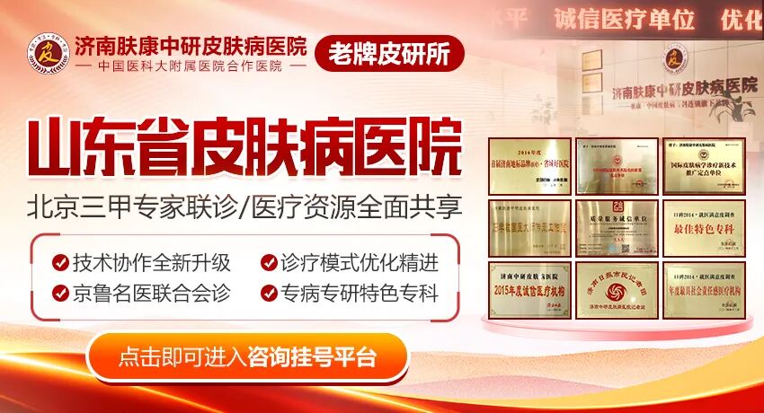 山东皮肤科就医攻略：打破排队枷锁，畅享在线快速预约挂号！山东皮肤病医院预约挂号—山东皮肤病研究院在线挂号—山东省皮研所挂号就医