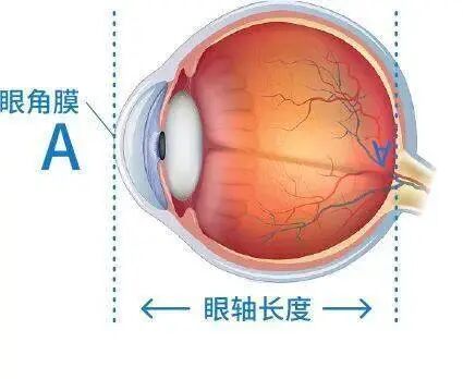 怎么测角膜直径一文教你看懂眼轴（光学生物测量）报告！_https://www.jmylbn.com_新闻资讯_第5张