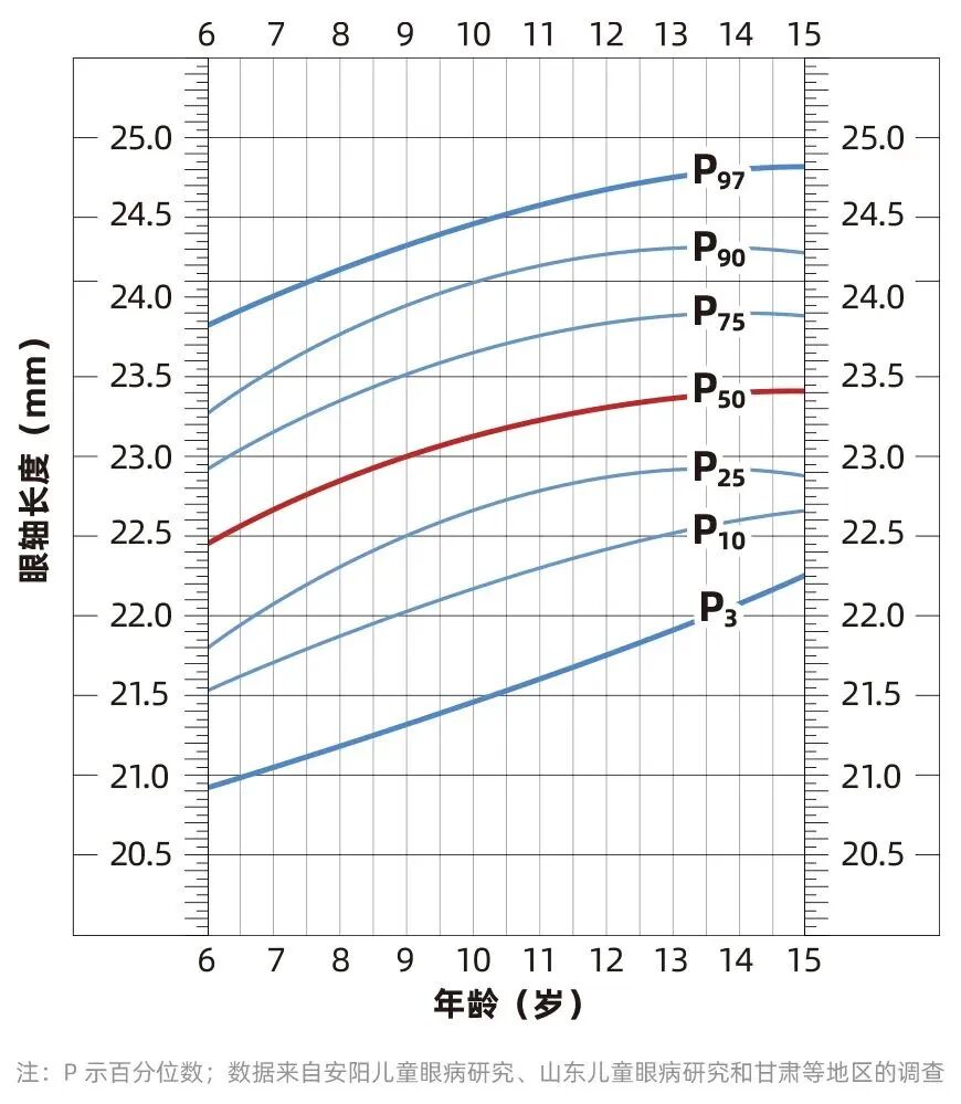 怎么测角膜直径一文教你看懂眼轴（光学生物测量）报告！_https://www.jmylbn.com_新闻资讯_第8张