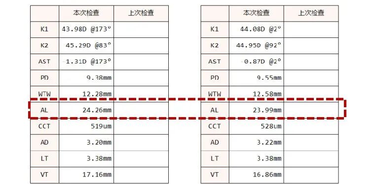 怎么测角膜直径一文教你看懂眼轴（光学生物测量）报告！_https://www.jmylbn.com_新闻资讯_第4张