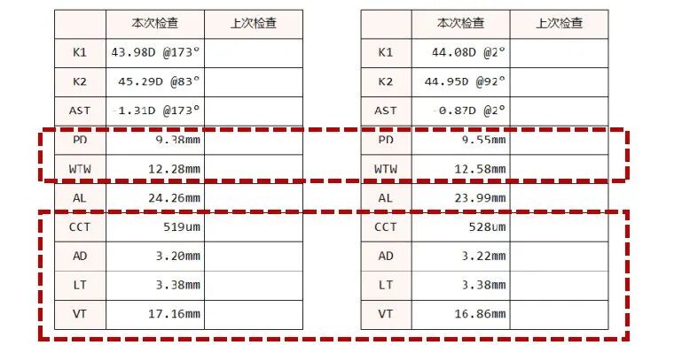 怎么测角膜直径一文教你看懂眼轴（光学生物测量）报告！_https://www.jmylbn.com_新闻资讯_第11张