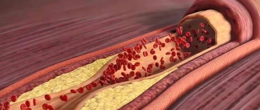 2025-05-28药事资讯