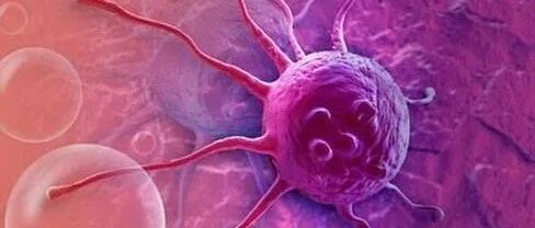 “肿瘤君”最喜欢这5个生活习惯！现在改还来得及！