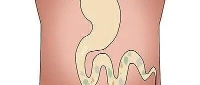 经常放屁是肝不好吗？“屁事”也要重视起来