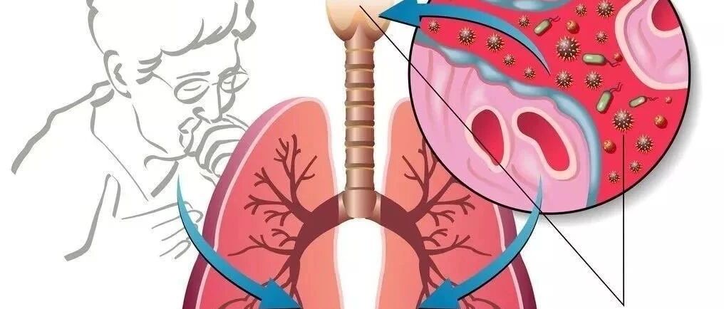 易引起干咳的十种药物，千万不要忽视！