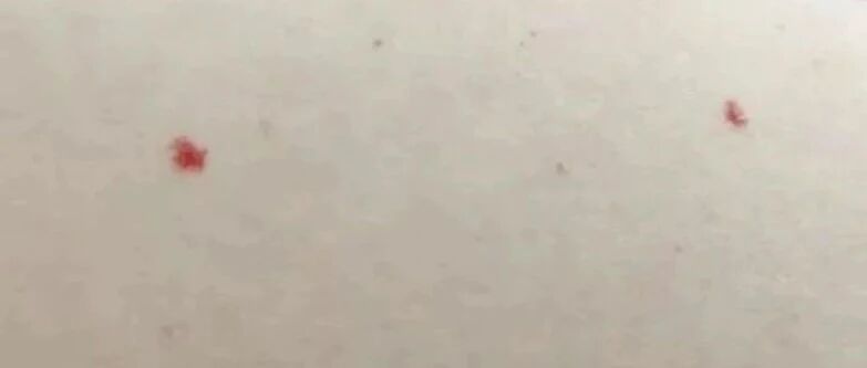 2025-06-04药事资讯