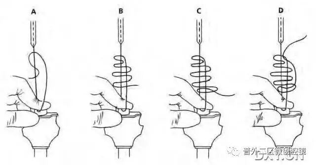 缝线怎么打结腹腔镜打结的技巧_https://www.jmylbn.com_新闻资讯_第6张
