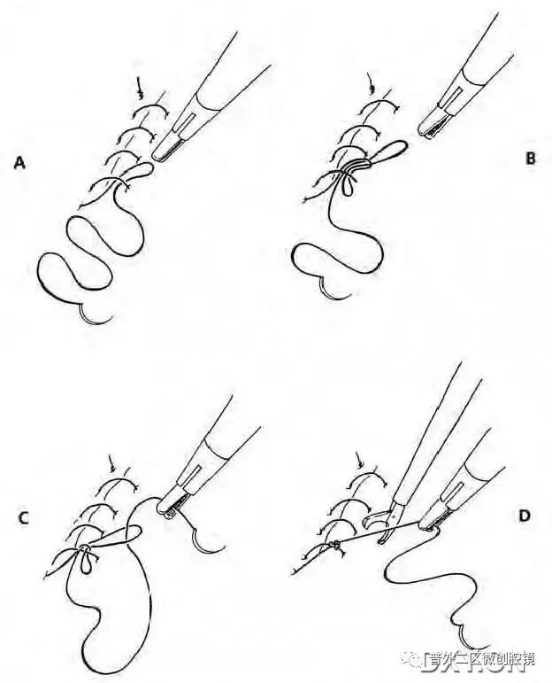 缝线怎么打结腹腔镜打结的技巧_https://www.jmylbn.com_新闻资讯_第13张