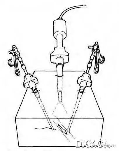 缝线怎么打结腹腔镜打结的技巧_https://www.jmylbn.com_新闻资讯_第3张