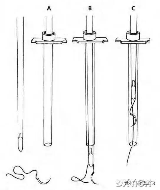 缝线怎么打结腹腔镜打结的技巧_https://www.jmylbn.com_新闻资讯_第4张