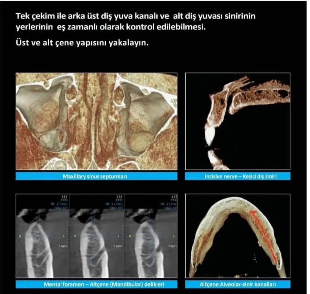 口腔ct什么牌子好【好物分享】口腔CBCT视野到底重不重要？多大视野最合适？_https://www.jmylbn.com_新闻资讯_第6张
