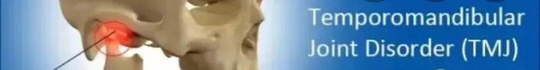 口腔ct什么牌子好【好物分享】口腔CBCT视野到底重不重要？多大视野最合适？_https://www.jmylbn.com_新闻资讯_第4张