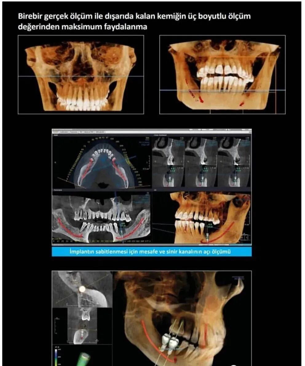 口腔ct什么牌子好【好物分享】口腔CBCT视野到底重不重要？多大视野最合适？_https://www.jmylbn.com_新闻资讯_第5张