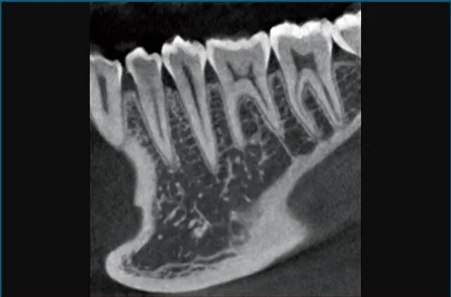 口腔ct什么牌子好【好物分享】口腔CBCT视野到底重不重要？多大视野最合适？_https://www.jmylbn.com_新闻资讯_第8张