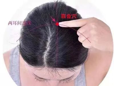 激光治疗仪有什么作用自然杀伤细胞（NK细胞）＋百会穴与（28孔）半导体激光治疗仪_https://www.jmylbn.com_新闻资讯_第8张