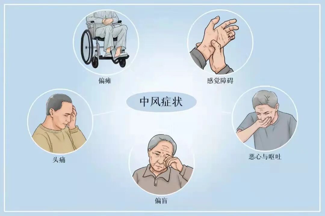 七旬老人中风失语,偏瘫, 医生及时取栓挽救其生命-武汉市中心医院神经