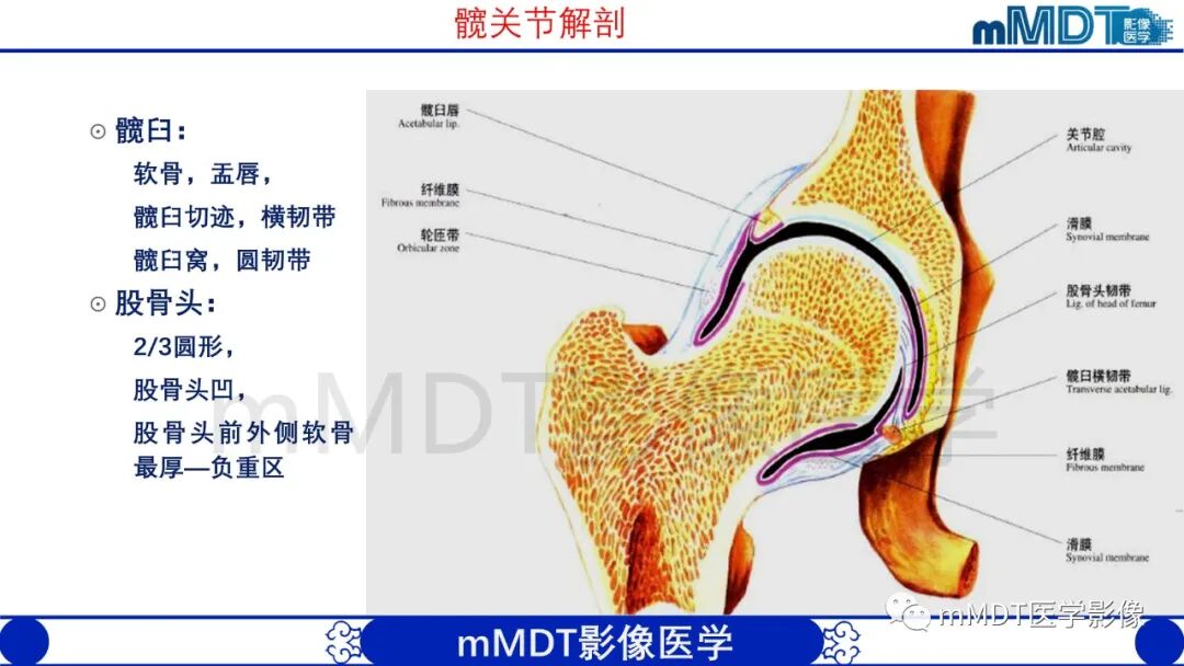 mmd在医学上什么意思股骨髋臼撞击症影像学改变_https://www.jmylbn.com_新闻资讯_第6张